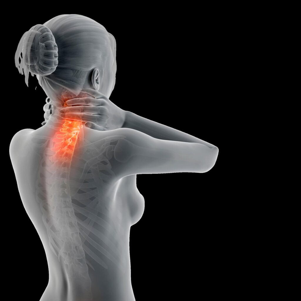Semana da terapia manual nas cervicalgias 1 Instituto Actiuni Andréia Kisner cervicalgia.jpeg Instituo Actiuni Andréia Kisner
